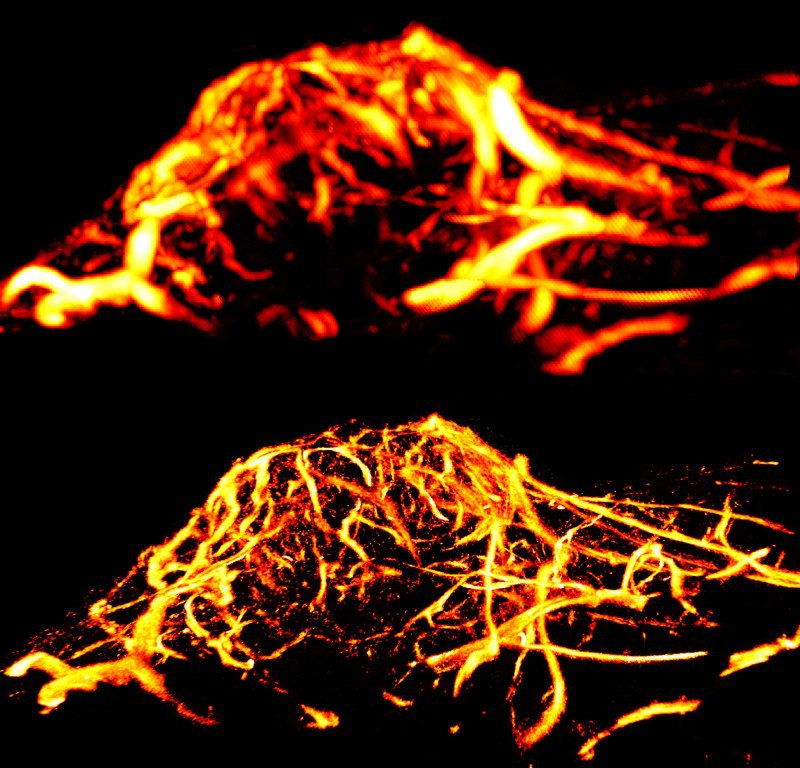 Two ultrashound images of a tumor, they are lit in orange and yellow. The top image is somewhat blurry, and the bottom image has defined vascularture. Photo from Beckman Institute website.